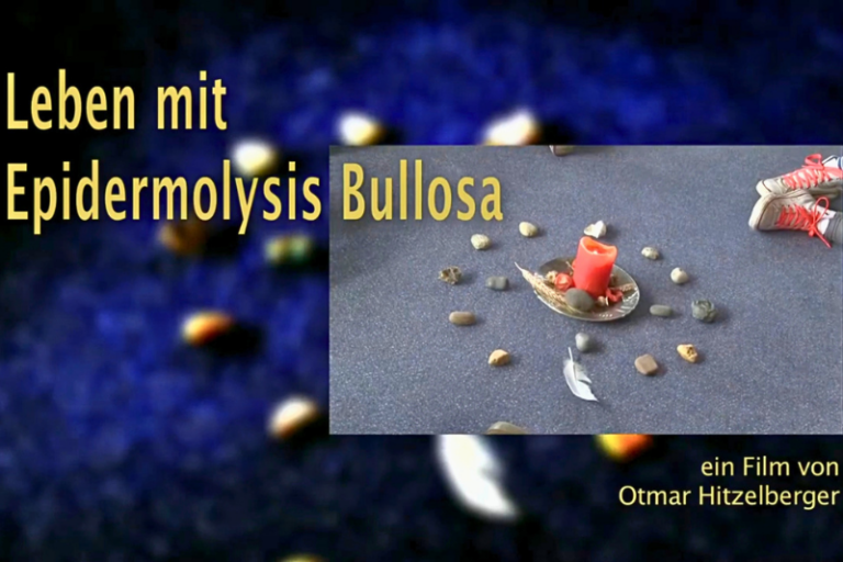 Szenenbild aus dem Dokumentarfilm "Leben mit Epidermolysis bullosa"